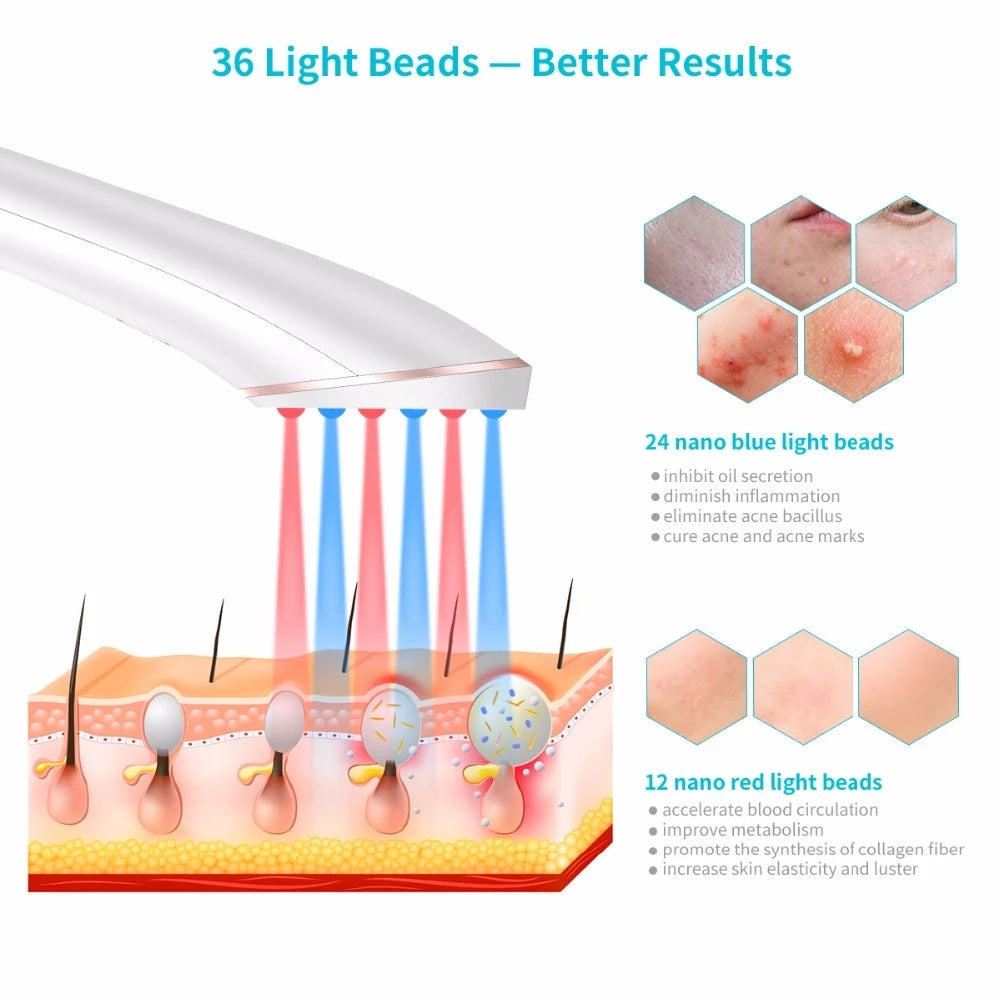 Acne Light Therapy | Effective Acne Treatment | Treatment | Acne