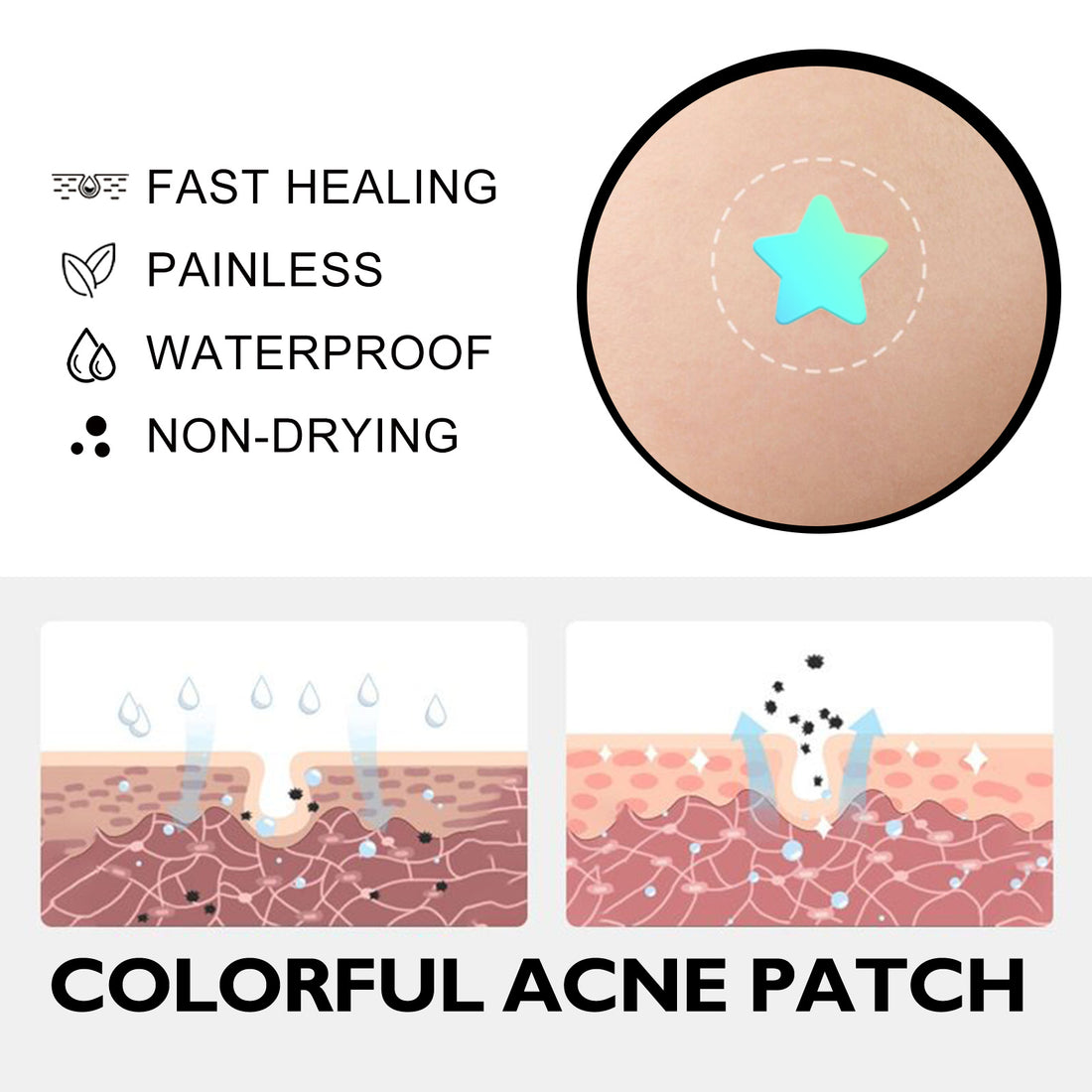 Hoygi Cute Colorful Acne Patches Reduce Acne & Pimples | Acne