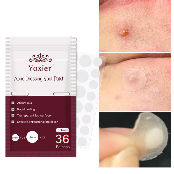 Skin Care Tools Acne Dressing Spot Patch | Effective Acne Treatment | Acne