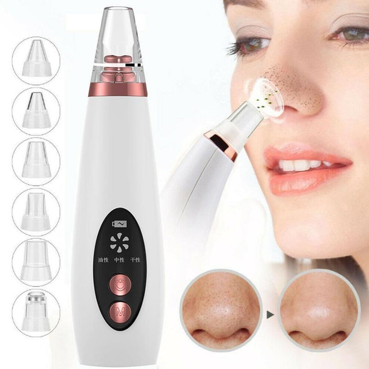 Blackhead Pore Cleaner | Blackheads Remover | Acne #amazon #glowboldbeauty #acne