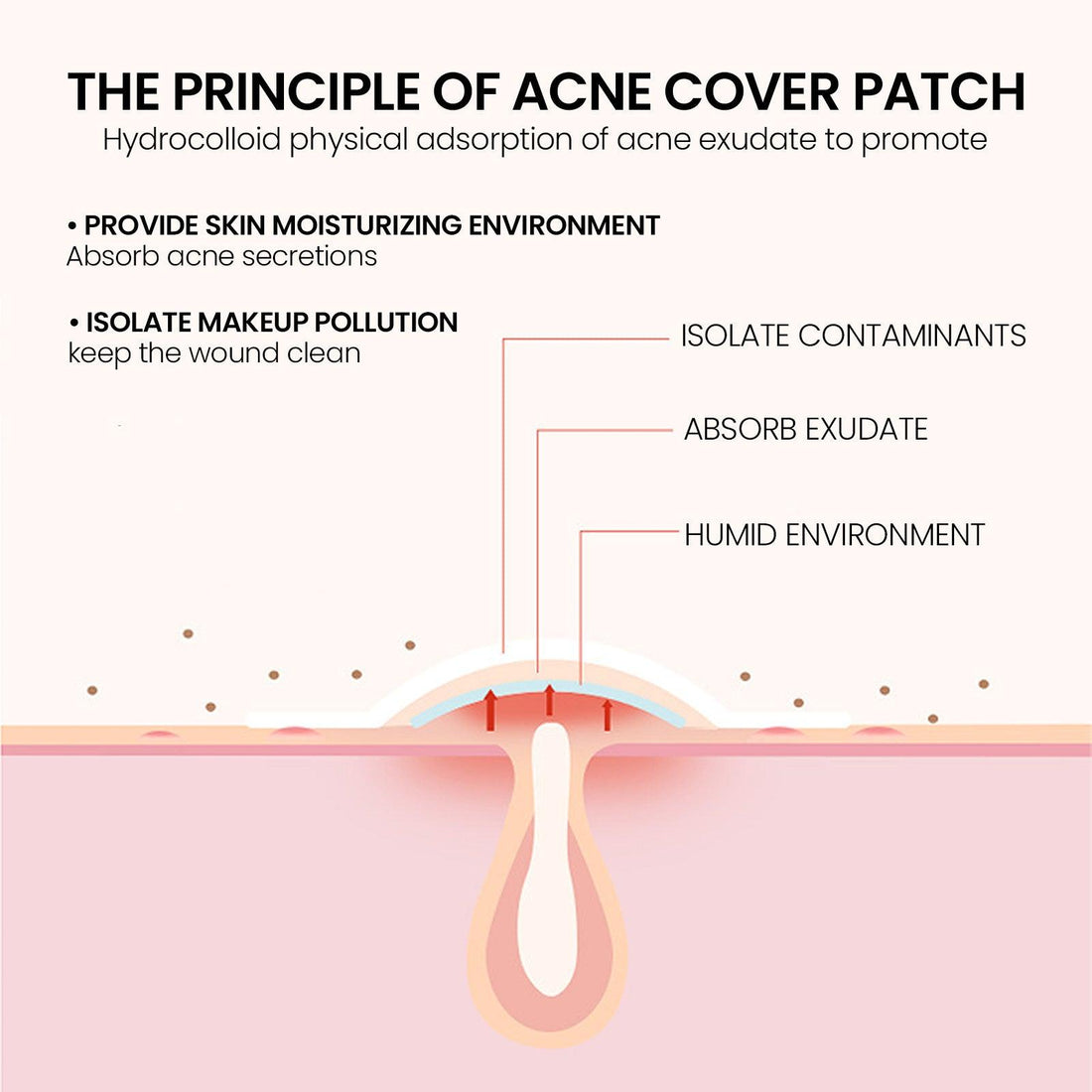 Pimple 200 Patches, Pimple Patches For Face, Hydrocolloid Acne Patches | Skin Care - GlowBoldBeauty